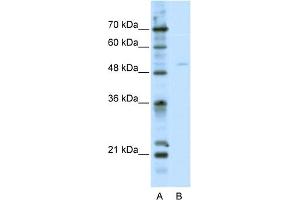 WB Suggested Anti-TFEB Antibody Titration:  2. (TFEB 抗体  (C-Term))