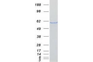 Western Blotting (WB) image for Coronin, Actin Binding Protein, 2A (CORO2A) (Transcript Variant 2) protein (Myc-DYKDDDDK Tag) (ABIN2712516)