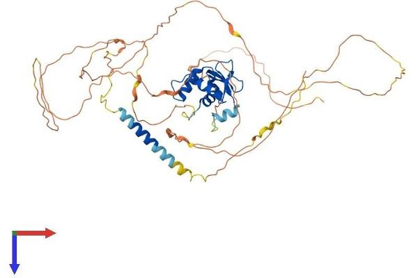 ETV5 Protein (AA 1-510) (His tag)