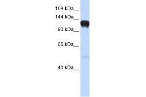 WB Suggested Anti-EPHA5 Antibody Titration: 0. (EPH Receptor A5 抗体  (Middle Region))