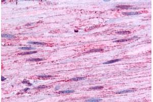 Immunohistochemical staining of human smooth muscle with BDKRB1 polyclonal antibody . (BDKRB1 抗体  (Extracellular Domain))