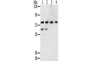Gel: 6 % SDS-PAGE, Lysate: 40 μg, Lane 1-4: A549 cells, hepg2 cells, lovo cells, A431 cells, Primary antibody: ABIN7131407(TMPRSS7 Antibody) at dilution 1/250, Secondary antibody: Goat anti rabbit IgG at 1/8000 dilution, Exposure time: 5 minutes (TMPRSS7 抗体)
