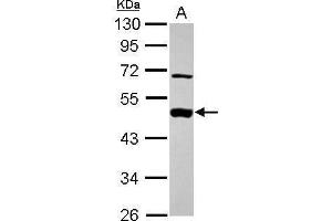 WB Image Sample (30 ug of whole cell lysate) A: A431 , 10% SDS PAGE antibody diluted at 1:1000 (MEK2 抗体)