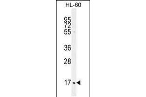 Western blot analysis in HL-60 cell line lysates (35ug/lane). (C1QC 抗体  (AA 93-120))