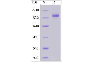 SARS-CoV-2 S protein, His Tag on  under reducing (R) condition. (SARS-CoV-2 Spike Protein (B.1.1.7 - alpha) (His tag))