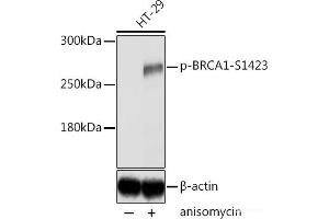 Western blot analysis of extracts of HT-29 cells using Phospho-BRCA1(S1423) Polyclonal Antibody at dilution of 1:2000. (BRCA1 抗体  (pSer1423))