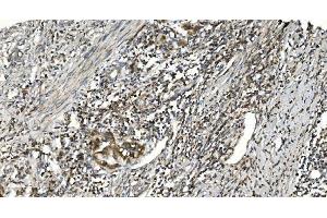 IHC analysis of NOX2/gp91phox/CYBB using anti-NOX2/gp91phox/CYBB antibody (ABIN7599875). (CYBB 抗体  (AA 124-559))