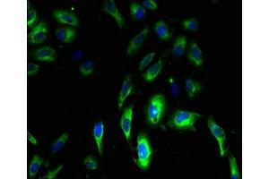 Immunofluorescent analysis of Hela cells using ABIN7147825 at dilution of 1:100 and Alexa Fluor 488-congugated AffiniPure Goat Anti-Rabbit IgG(H+L) (Clarin 3 抗体  (AA 39-91))