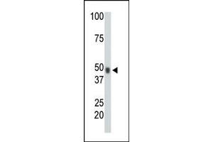 The anti-CHK Pab (ABIN391080 and ABIN2841225) is used in Western blot to detect CHK in mouse heart tissue lysate. (MATK 抗体  (N-Term))