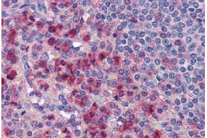 Human Spleen, Neutrophils (formalin-fixed, paraffin-embedded) stained with IL27 antibody ABIN351442 at 5 ug/ml followed by biotinylated goat anti-rabbit IgG secondary antibody ABIN481713, alkaline phosphatase-streptavidin and chromogen. (IL-27 抗体  (Internal Region))