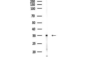 anti-Spermidine/spermine N1-Acetyltransferase 1 (SAT1) (C-Term) antibody