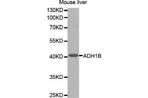 Western Blotting (WB) image for anti-Alcohol Dehydrogenase 1B (Class I), beta Polypeptide (ADH1B) (AA 206-375) antibody (ABIN1678576) (ADH1B 抗体  (AA 206-375))