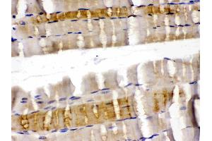 Immunohistochemistry (IHC) image for anti-Cofilin 2 (CFL2) (AA 121-153), (C-Term) antibody (ABIN4886538)