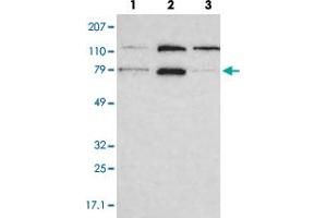 Western blot analysis of lane 1: RT-4, lane 2: EFO-21 and lane 3: A-431 cell lysates using PNN polyclonal antibody . (PNN 抗体)