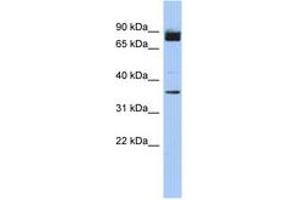 Image no. 1 for anti-Coiled-Coil Serine-Rich Protein 1 (CCSER1) (AA 71-120) antibody (ABIN6743951) (CCSER1 抗体  (AA 71-120))