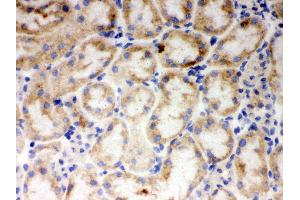 Immunohistochemistry (IHC) image for anti-Cytochrome P450, Family 1, Subfamily A, Polypeptide 1 (CYP1A1) (AA 183-320) antibody (ABIN3043819)