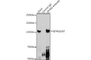 Immunoprecipitation analysis of 300 μg extracts of HeLa cells using 3 μg EIF4G2/p97 antibody (ABIN3016940, ABIN3016941, ABIN3016942 and ABIN6219894). (EIF4G2 抗体  (AA 750-850))