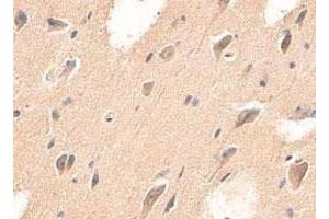Immunohistochemical staining of formalin-fixed paraffin-embedded human brain tissue with ADAMTS4 polyclonal antibody  at 1 : 200 dilution. (ADAMTS4 抗体  (C-Term))