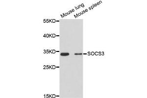 Western blot analysis of extracts of various cell lines, using SOCS3 antibody (ABIN2650956) at 1:3000 dilution. (SOCS3 抗体)