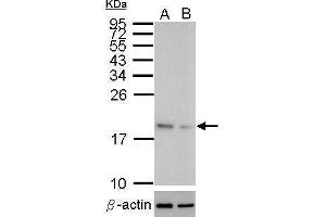 Western Blotting (WB) image for anti-Superoxide Dismutase 1, Soluble (SOD1) antibody (ABIN2854793)