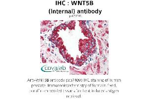 Image no. 2 for anti-Wingless-Type MMTV Integration Site Family, Member 5B (WNT5B) (Internal Region) antibody (ABIN1740832) (WNT5B 抗体  (Internal Region))