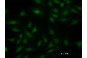 Immunofluorescence (IF) image for anti-SGT1, Suppressor of G2 Allele of SKP1 (SUGT1) (AA 151-260) antibody (ABIN564734)
