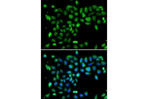 Immunofluorescence analysis of U2OS cells using DYRK2 antibody (ABIN5974219). (DYRK2 抗体)