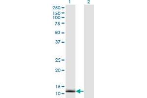 Western Blot analysis of CRABP2 expression in transfected 293T cell line by CRABP2 monoclonal antibody (M01), clone 4F2. (CRABP2 抗体  (AA 1-138))