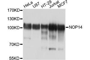Western blot analysis of extracts of various cell lines, using NOP14 antibody. (Nop14 抗体)