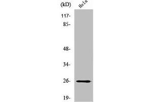 Western Blot analysis of HeLa cells using UMP-CMP Kinase Polyclonal Antibody (Cytidine Monophosphate (UMP-CMP) Kinase 1, Cytosolic (CMPK1) (N-Term) 抗体)