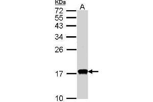 WB Image Sample(30 ug whole cell lysate) A:HeLa S3, 15% SDS PAGE antibody diluted at 1:1000 (CDA 抗体)