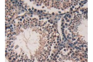 IHC-P analysis of Mouse Testis Tissue, with DAB staining. (FKBP10 抗体  (AA 316-573))
