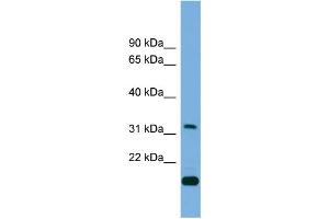 Western Blotting (WB) image for anti-CTD (Carboxy-terminal Domain, RNA Polymerase II, Polypeptide A) Small Phosphatase 2 (CTDSP2) (Middle Region) antibody (ABIN2774003)