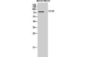 Western Blotting (WB) image for anti-CD180 Molecule (CD180) (Internal Region) antibody (ABIN3178975) (CD180 抗体  (Internal Region))