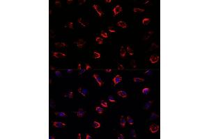 Immunofluorescence analysis of L929 cells using IL11 antibody (ABIN6128128, ABIN6142292, ABIN6142293 and ABIN6219040) at dilution of 1:100. (IL-11 抗体  (AA 22-199))