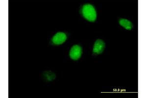 Immunofluorescence of purified MaxPab antibody to RUNX3 on HeLa cell. (RUNX3 抗体  (AA 1-429))