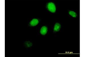 Immunofluorescence of purified MaxPab antibody to RUNX3 on HeLa cell.