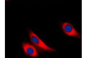 Immunofluorescent analysis of Galectin 9 staining in THP1 cells. (Galectin 9 抗体  (Center))
