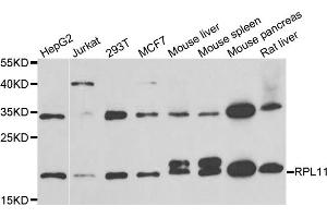 Western blot analysis of extracts of various cell lines, using RPL11 antibody (ABIN5973808) at 1/1000 dilution. (RPL11 抗体)
