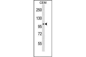 Western blot analysis of DNA ligase 3 Antibody (C-term) in CEM cell line lysates (35ug/lane).