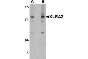 Western Blotting (WB) image for anti-Killer Cell Lectin-Like Receptor, Subfamily A, Member 2 (Klra2) (C-Term) antibody (ABIN1030472) (Klra2 抗体  (C-Term))