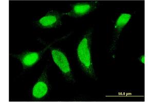Immunofluorescence of monoclonal antibody to CSNK1D on HeLa cell.