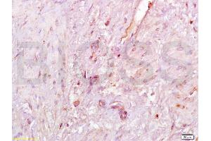 Immunohistochemistry (IHC) image for anti-Sirtuin 1 (SIRT1) (AA 101-200) antibody (ABIN729853)