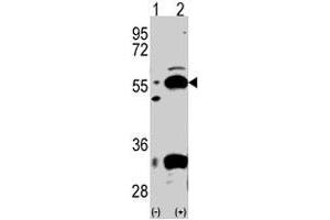 Western blot analysis of PDX1 (arrow) using rabbit PDHX polyclonal antibody . (PDHX 抗体  (C-Term))