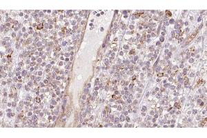 anti-Cysteine-S-conjugate beta-Lyase (CCBL1) (Internal Region) antibody