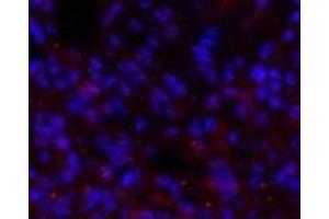 Immunofluorescence analysis of Rat lung tissue using BRCA1 Polyclonal Antibody at dilution of 1:200. (BRCA1 抗体)
