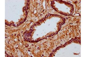 IHC image of ABIN7174945 diluted at 1:700 and staining in paraffin-embedded human prostate tissue performed on a Leica BondTM system. (MYO1E 抗体  (AA 62-189))