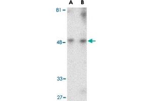 Western blot analysis of HAVCR1 in human uterus tissue lysate with HAVCR1 polyclonal antibody  at (A) 1 and (B) 2 ug/mL . (HAVCR1 抗体  (Internal Region))