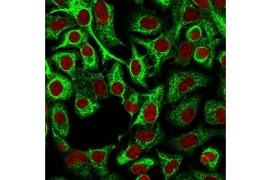 Immunofluorescence (IF) image for anti-Keratin 14 (KRT14) (C-Term) antibody (ABIN6939906)
