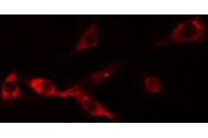 ABIN6274254 staining Hela cells by IF/ICC. (NBL1 抗体  (C-Term))